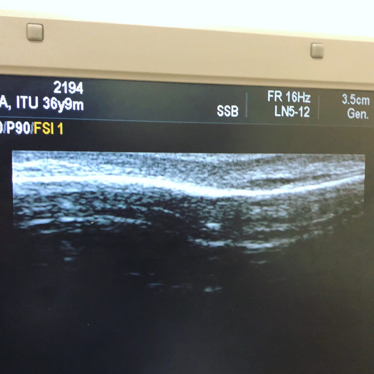 盛り上がってる 盛り上がってる